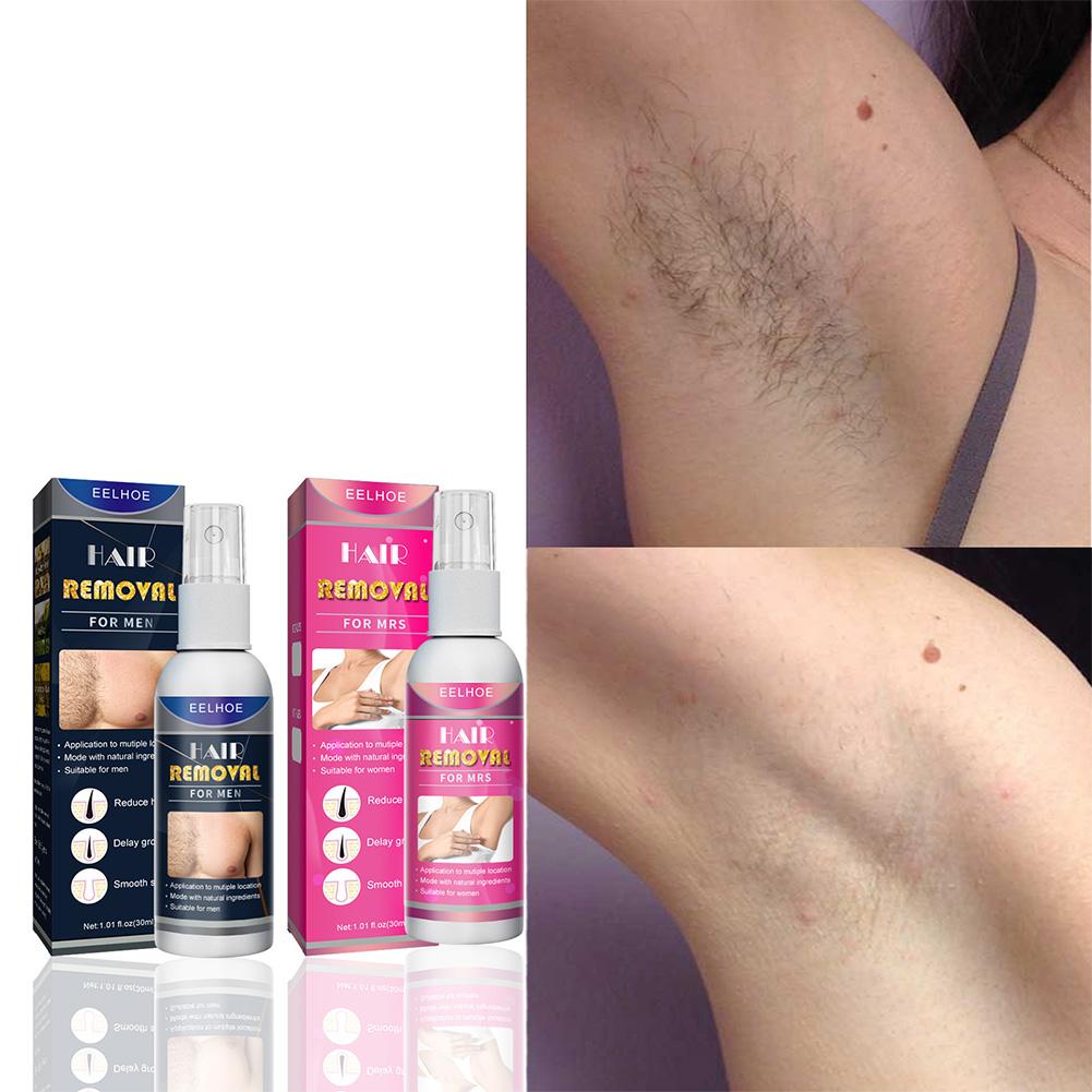 1/2PCS Super Natural Painless  - Body Lotion review and price